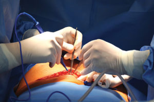 general-surgery-and-surgical-gastroenterology